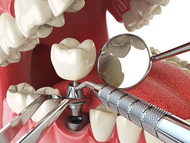 Best Cracked Tooth Emergency Dentist  in Fairfax, VA